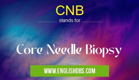 CNB