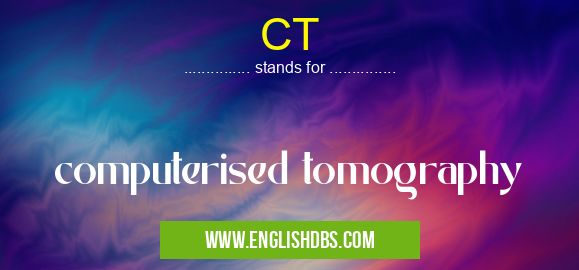 CT means computerised tomography CT