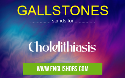 GALLSTONES means Cholelithiasis GALLSTONES