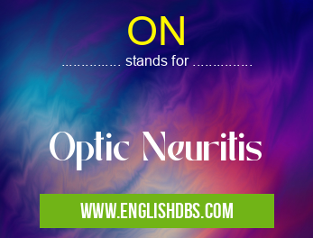 ON means Optic Neuritis ON